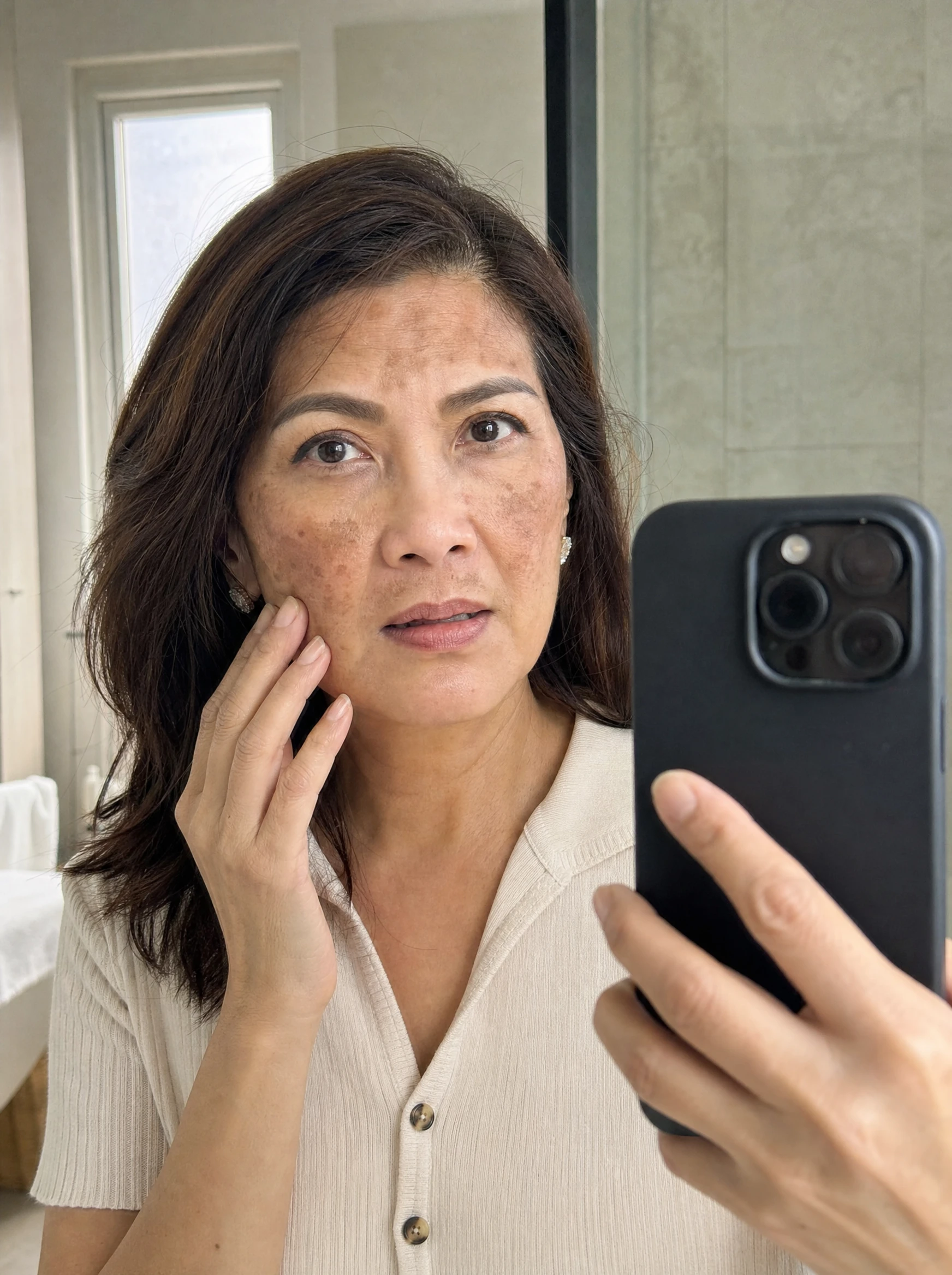Melasma and dark spots